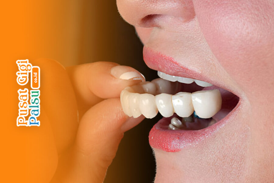 artikel pusat gigi palsu 1