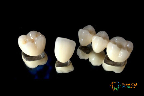 layanan pusat gigi palsu 2