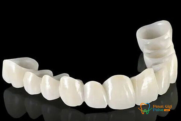 layanan pusat gigi palsu
